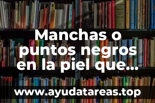 Que es bueno para que no queden cicatrices dela varicela 4 Manchas o puntos negros en la piel que es